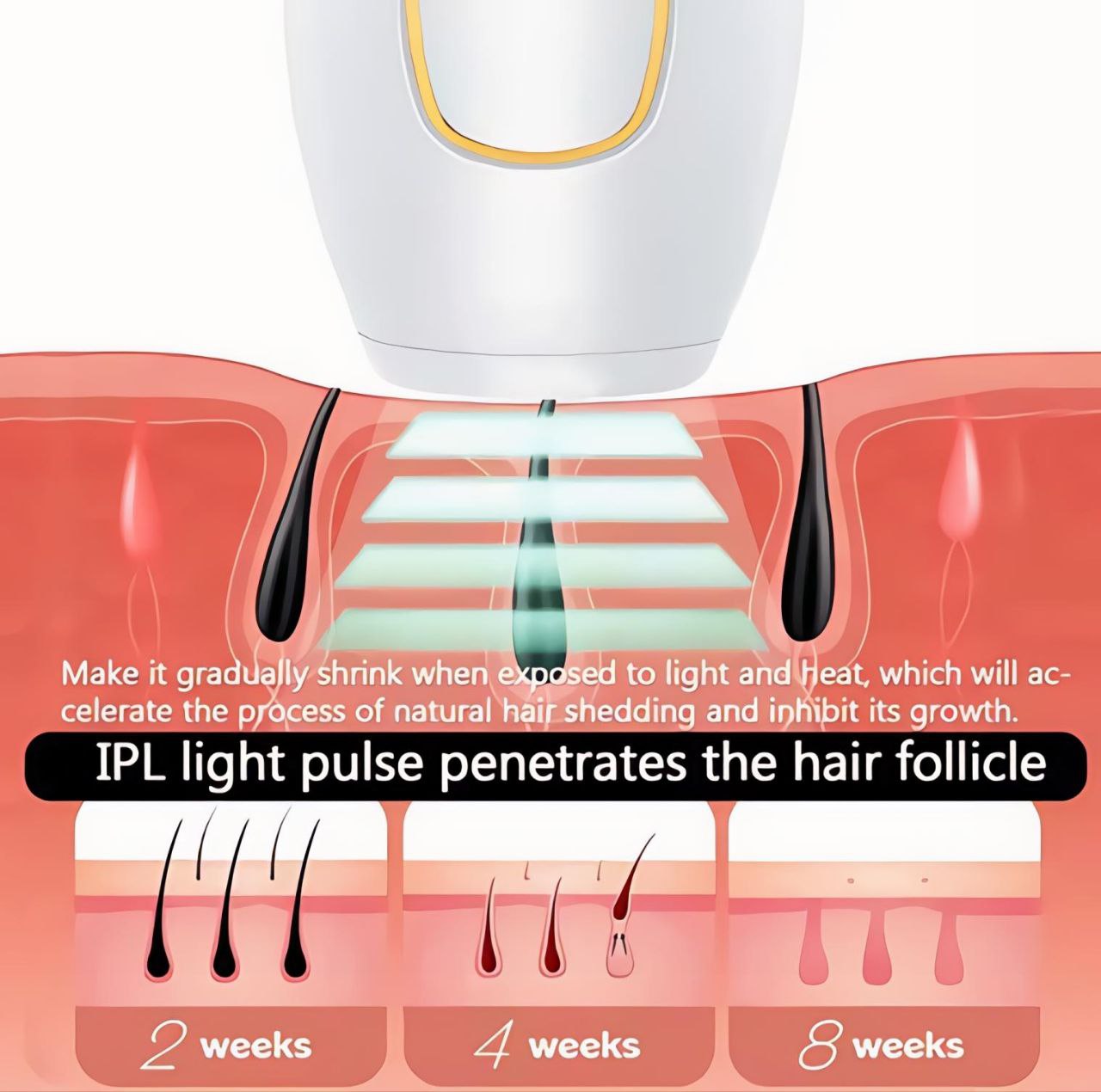 SmoothGlow™ IPL