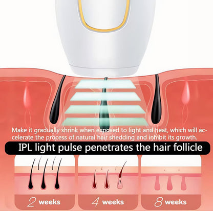 SmoothGlow™ IPL